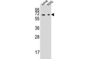 Western Blotting (WB) image for anti-Dihydropyrimidinase (DPYS) antibody (ABIN2997327) (DPYS anticorps)