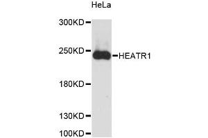 Western blot analysis of extracts of HeLa cells, using HEATR1 antibody (ABIN6290508) at 1:3000 dilution. (HEATR1 anticorps)