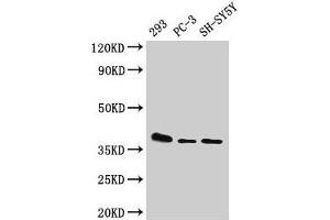 Western Blot Positive WB detected in: 293 whole cell lysate, PC-3 whole cell lysate, SH-SY5Y whole cell lysate All lanes: ELOVL4 antibody at 1:500 Secondary Goat polyclonal to rabbit IgG at 1/50000 dilution Predicted band size: 37 kDa Observed band size: 37 kDa (ELOVL4 anticorps  (AA 270-314))