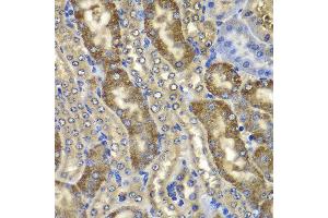 Immunohistochemistry of paraffin-embedded mouse kidney using NMT2 antibody at dilution of 1:100 (x400 lens).
