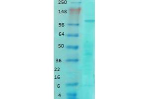 Western Blotting rat brain membrane GluN1NR1 1 in 1000.