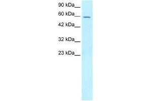 FOXG1A antibody used at 5-8 ug/ml to detect target protein.