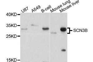 Western blot analysis of extract of various cells, using SCN3B antibody. (SCN3B anticorps)