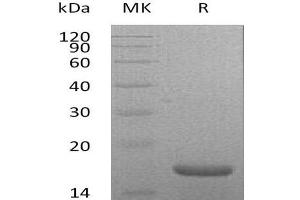 Western Blotting (WB) image for Interleukin 21 (IL21) protein (His tag) (ABIN7320586) (IL-21 Protein (His tag))