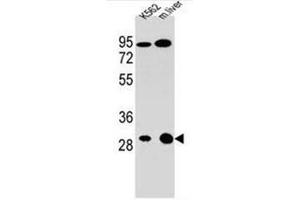 Western blot analysis of ETFA Antibody (C-term) Cat. (ETFA anticorps  (C-Term))