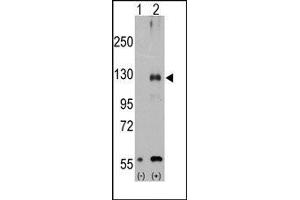 Image no. 1 for anti-Transient Receptor Potential Cation Channel, Subfamily M, Member 8 (TRPM8) (Middle Region) antibody (ABIN360716) (TRPM8 anticorps  (Middle Region))