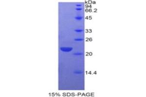 SDS-PAGE analysis of Human CLEC3B Protein.