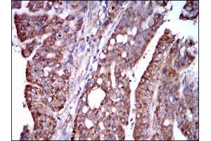 Immunohistochemistry (IHC) image for anti-Signal Transducer and Activator of Transcription 5A (STAT5A) (AA 583-794) antibody (ABIN1845625) (STAT5A anticorps  (AA 583-794))