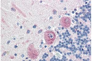 Human Brain, Cerebellum (formalin-fixed, paraffin-embedded) stained with KIAA0152 antibody ABIN351427 at 5 ug/ml followed by biotinylated goat anti-rabbit IgG secondary antibody ABIN481713, alkaline phosphatase-streptavidin and chromogen.