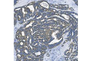 IHC analysis of EEF2/Elongation factor 2 using anti-EEF2/Elongation factor 2 antibody (ABIN7603142). (EEF2 anticorps  (N-Term))