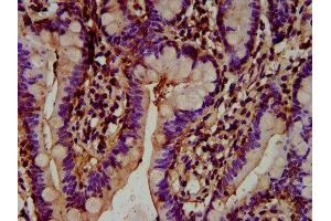 IHC image of ABIN7164423 diluted at 1:300 and staining in paraffin-embedded human small intestine tissue performed on a Leica BondTM system. (HECTD2 anticorps  (AA 674-776))