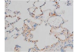 ABIN6267399 at 1/200 staining Rat lung tissue sections by IHC-P. (CREB1 anticorps  (pSer142))