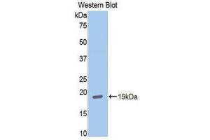 Western Blotting (WB) image for anti-Hexokinase 1 (HK1) (AA 530-675) antibody (ABIN1859171) (Hexokinase 1 anticorps  (AA 530-675))