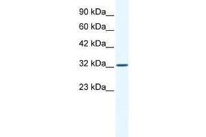WB Suggested Anti-SNAPC2 Antibody Titration:  1. (SNAPC2 anticorps  (Middle Region))
