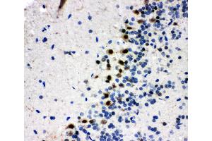 Anti-B MyB antibody, IHC(P) IHC(P): Rat Brain Tissue (MYBL2 anticorps  (N-Term))