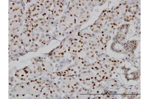 Immunoperoxidase of monoclonal antibody to CMAS on formalin-fixed paraffin-embedded human salivary gland. (CMAS anticorps  (AA 164-263))