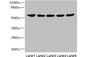 Western blot, All lanes: IFNLR1 antibody at 3. (IL28RA anticorps  (AA 21-228))