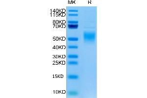 Human Fc epsilon RI alpha/FCER1a on Tris-Bis PAGE under reduced condition.