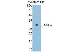 Western Blotting (WB) image for anti-Janus Kinase 2 (JAK2) (AA 564-809) antibody (ABIN3203631) (JAK2 anticorps  (AA 564-809))