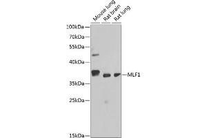 Western blot analysis of extracts of various cell lines, using MLF1 antibody (ABIN6128237, ABIN6143874, ABIN6143876 and ABIN6217281) at 1:1000 dilution. (MLF1 anticorps  (AA 1-268))
