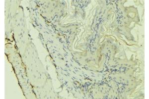 ABIN6273220 at 1/100 staining Mouse colon tissue by IHC-P. (CX3CL1 anticorps  (Internal Region))