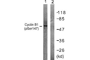 Immunohistochemistry analysis of paraffin-embedded human placenta tissue using Cyclin B1 (Phospho-Ser147) antibody. (Cyclin B1 anticorps  (pSer147))