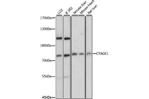 Western blot analysis of extracts of various cell lines, using CT antibody (ABIN6129529, ABIN6139174, ABIN6139175 and ABIN6217150) at 1:3000 dilution. (CTAGE1 anticorps  (AA 370-520))