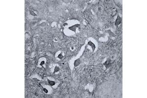 IHC on mouse brain (cryo section) using Rabbit antibody to RhoA  at a concentration of 15 µg/ml, incubated overnight and developed with DAB Ni.