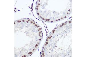Immunohistochemistry of paraffin-embedded mouse testis using NFIA Rabbit pAb (ABIN1681040, ABIN3017626, ABIN3017627 and ABIN6220178) at dilution of 1:200 (40x lens).