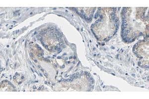 ABIN6269374 at 1/100 staining Human prostate tissue by IHC-P.