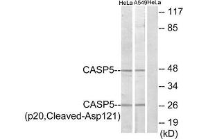 Western blot analysis of extracts from HeLa cells and A549 cells, treated with etoposide (25uM, 24hours), using CASP5 (p20, Cleaved-Asp121) antibody. (CASP5 anticorps  (Cleaved-Asp121, Internal Region))