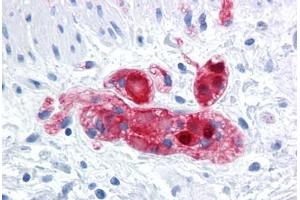Human Colon, submucosal plexus: Formalin-Fixed, Paraffin-Embedded (FFPE)
