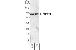 anti-Zinc Finger Protein 324 (ZNF324) (AA 503-553) antibody