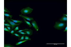 Immunofluorescence of purified MaxPab antibody to PCID2 on HeLa cell. (PCID2 anticorps  (AA 1-397))