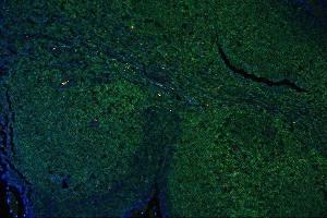 IF analysis of CD45 using anti-CD45 antibody (ABIN3043913) CD45 was detected in paraffin-embedded section of human tonsil tissues.