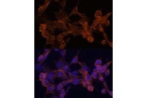 Immunofluorescence analysis of NIH/3T3 cells using β-arrestin1 antibody (ABIN6127452, ABIN6137135, ABIN6137136 and ABIN6213655) at dilution of 1:100. (beta Arrestin 1 anticorps  (AA 169-418))