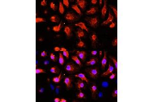Immunofluorescence analysis of HeLa cells using  antibody (ABIN1678557, ABIN3017993, ABIN3017994, ABIN5664400 and ABIN6220331) at dilution of 1:100 (40x lens).