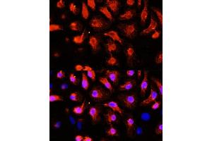 Immunofluorescence analysis of HeLa cells using  antibody (ABIN1678557, ABIN3017993, ABIN3017994, ABIN5664400 and ABIN6220331) at dilution of 1:100 (40x lens). (ACTN2 anticorps  (AA 1-250))