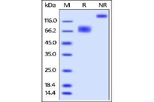 Biotinylated Human 2B4, Fc,Avitag on  under reducing (R) and ing (NR) conditions.