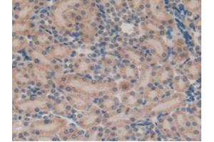 IHC-P analysis of Rat Kidney Tissue, with DAB staining. (SFTPB anticorps  (AA 111-329))