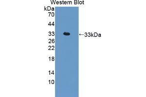 Detection of Recombinant IL22R, Rat using Polyclonal Antibody to Interleukin 22 Receptor (IL22R) (IL22R anticorps  (AA 242-485))