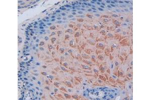 IHC-P analysis of Human Tissue, with DAB staining. (Envoplakin anticorps  (AA 3-258))