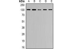 Western blot analysis of Collagen 4 alpha 1 expression in Hela (A), MCF7 (B), U2OS (C), HEK293T (D), VEC (E) whole cell lysates. (COL4A1 anticorps)
