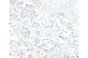 Immunohistochemistry (IHC) image for anti-Mismatch Repair Protein 2 (MSH2) (AA 625-675) antibody (ABIN7453978)