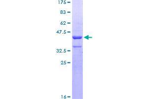 Image no. 1 for Zinc Finger, HIT-Type Containing 3 (ZNHIT3) (AA 1-155) protein (GST tag) (ABIN1326483)