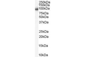Western Blotting (WB) image for anti-Aurora Kinase A (AURKA) (Middle Region) antibody (ABIN2785452) (Aurora A anticorps  (Middle Region))