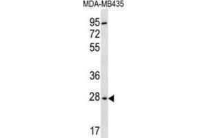 Western Blotting (WB) image for anti-2,3-bisphosphoglycerate Mutase (BPGM) antibody (ABIN2996852) (BPGM anticorps)