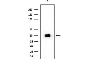 anti-NOP2/Sun Domain Family, Member 5 (NSUN5) antibody