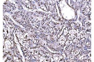 IHC analysis of PSMD8 using anti-PSMD8 antibody (ABIN7602571).