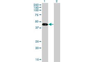 Western Blotting (WB) image for anti-Zinc Finger Protein 3 (ZNF3) (AA 1-111) antibody (ABIN599466) (ZNF3 anticorps  (AA 1-111))